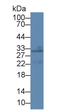 Western Blot; Sample: Recombinant protein.