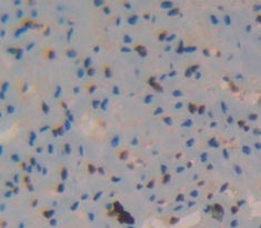ATPase, Na+/K+ Transporting Beta 4 Polypeptide (ATP1b4) Polyclonal Antibody - image 3