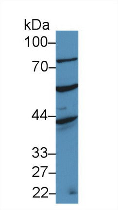 Western Blot; Sample: Recombinant protein.