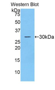 DAB staining on IHC-P; Samples: Human Cerebrum Tissue; Primary Ab: 20μg/ml Rabbit Anti-Human ADAM20 Antibody Second Ab: 2µg/mL HRP-Linked Caprine Anti-Rabbit IgG Polyclonal Antibody