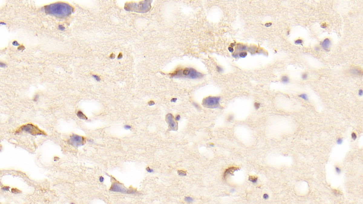 DAB staining on IHC-P. Samples: Human Tissue)