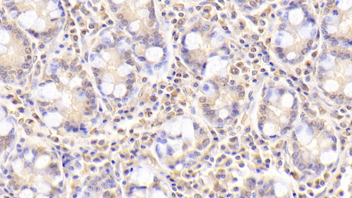 A Disintegrin And Metalloprotease 20 (ADAM20) Polyclonal Antibody - image 5