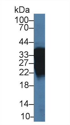DAB staining on IHC-P; Samples: Human Liver Tissue; Primary Ab: 10µg/ml Rabbit Anti-Human ARL1 Antibody Second Ab: 2µg/mL HRP-Linked Caprine Anti-Rabbit IgG Polyclonal Antibody