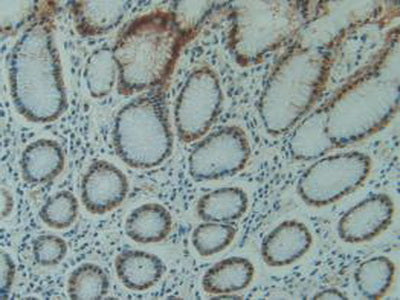 Aldose Reductase Like Protein 1 (ARL1) Polyclonal Antibody - image 5