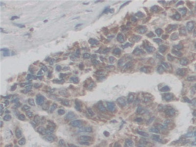 DAB staining on IHC-P; Samples: Human Kidney Tissue.