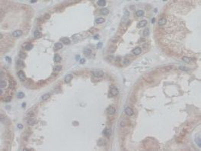 Coupling Factor 6 (CF6) Polyclonal Antibody - image 5