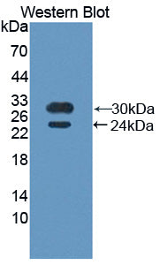 BMX Non Receptor Tyrosine Kinase (BMX) Polyclonal Antibody - image 2