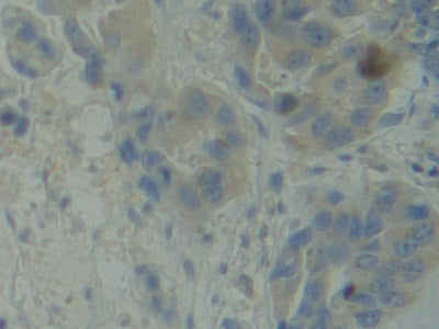 DAB staining on IHC-P; Samples: Human Kidney Tissue