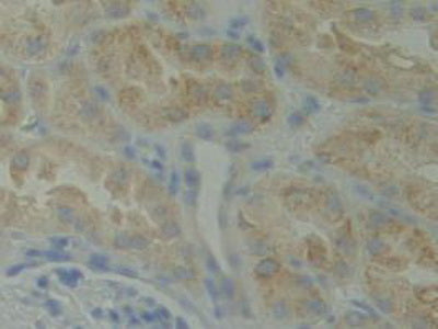 BMX Non Receptor Tyrosine Kinase (BMX) Polyclonal Antibody - image 4