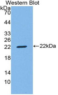 Used in DAB staining on fromalin fixed paraffin-embedded Liver tissue