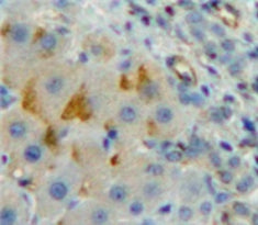 Cluster Of Differentiation 8b (CD8b) Polyclonal Antibody - image 4