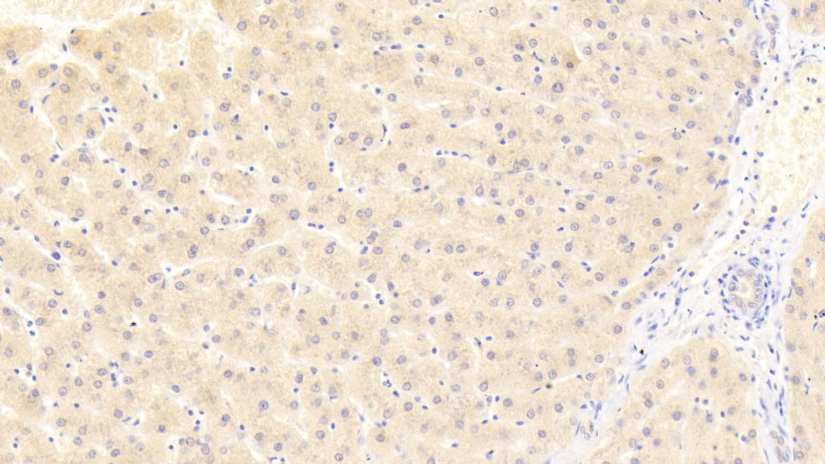 DABstainingonIHC-P.Samples:HumanTissue)