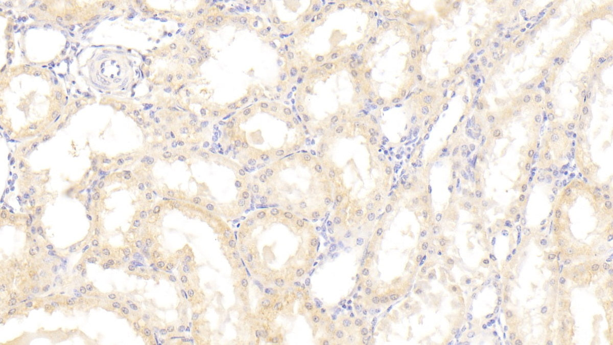 Dickkopf Related Protein 4 (DKK4) Polyclonal Antibody - image 4