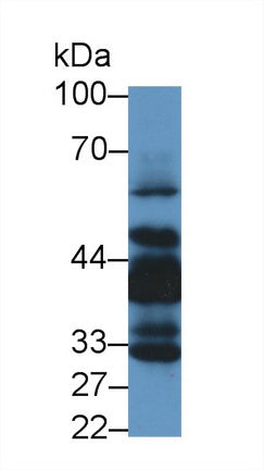 Western Blot; Sample: Recombinant protein.