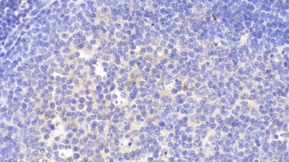 LIM And Senescent Cell Antigen Like Domains Protein 1 (LIMS1) Polyclonal Antibody - image 5