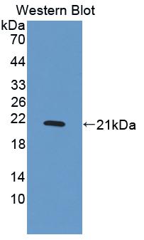 Neuroblastoma, Suppression Of Tumorigenicity 1 (NBL1) Polyclonal Antibody - image 2