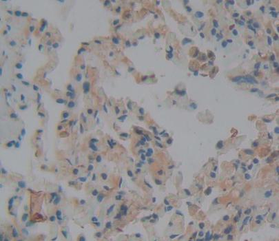 Neuroblastoma, Suppression Of Tumorigenicity 1 (NBL1) Polyclonal Antibody - image 3