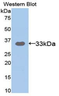 Suppression Of Tumorigenicity 14 (ST14) Polyclonal Antibody - image 2
