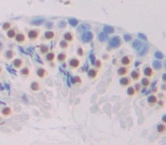T-Box Protein 21 (TBX21) Polyclonal Antibody - image 3