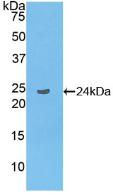 Linker For Activation Of T-Cells Family, Member 2 (LAT2) Polyclonal Antibody - image 2