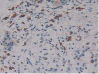 Linker For Activation Of T-Cells Family, Member 2 (LAT2) Polyclonal Antibody - image 4