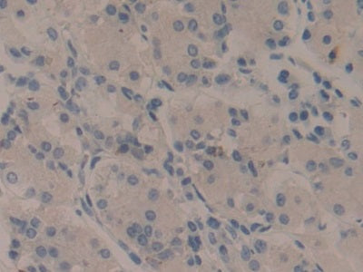 Wingless Type MMTV Integration Site Family, Member 11 (WNT11) Polyclonal Antibody - image 4