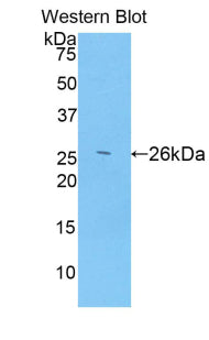 A Disintegrin And Metalloproteinase With Thrombospondin 12 (ADAMTS12) Polyclonal Antibody - image 3