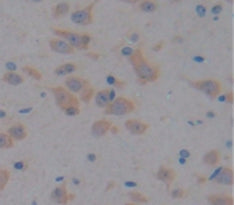 A Disintegrin And Metalloproteinase With Thrombospondin 12 (ADAMTS12) Polyclonal Antibody - image 4
