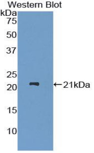 A Disintegrin And Metalloproteinase With Thrombospondin 12 (ADAMTS12) Polyclonal Antibody - image 2