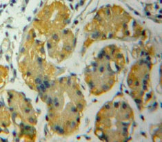 A Disintegrin And Metalloproteinase With Thrombospondin 12 (ADAMTS12) Polyclonal Antibody - image 3