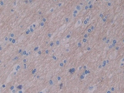DAB staining on IHC-P; Samples: Mouse Intestine Tissue)