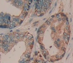 A Disintegrin And Metalloproteinase With Thrombospondin 16 (ADAMTS16) Polyclonal Antibody - image 3