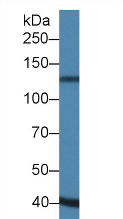Western Blot; Sample: Recombinant protein.