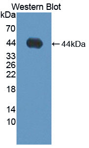 Used in DAB staining on fromalin fixed paraffin- embedded Kidney tissue