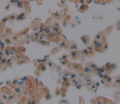 A Disintegrin And Metalloproteinase With Thrombospondin 19 (ADAMTS19) Polyclonal Antibody - image 4