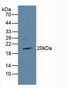 Western Blot; Sample: Recombinant TIRAP, Human.