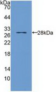 DAB staining on IHC-P; Samples: Human Colon Tissue; Primary Ab: 20μg/ml Rabbit Anti-Human TIRAP Antibody Second Ab: 2µg/mL HRP-Linked Caprine Anti-Rabbit IgG Polyclonal Antibody