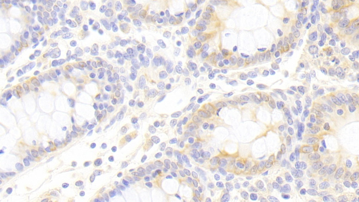 DAB staining on IHC-P. Samples: Human Tissue)