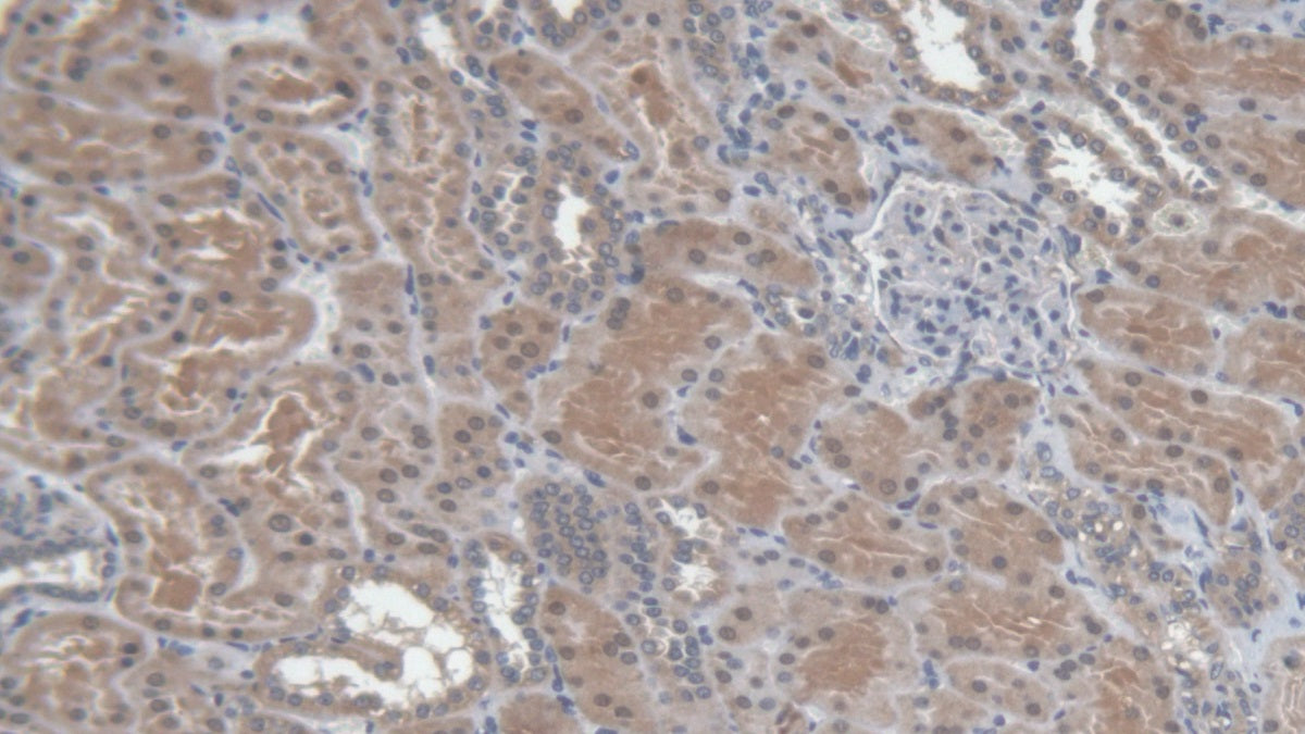 Toll Interleukin 1 Receptor Domain Containing Adaptor Protein (TIRAP) Polyclonal Antibody - image 5