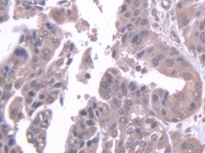 Serine/Threonine Kinase 39 (STK39) Polyclonal Antibody - image 3