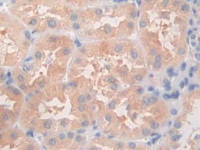 DAB staining on fromalin fixed paraffin- embedded Kidney tissue)