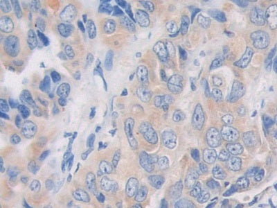 Angiopoietin Like Protein 5 (ANGPTL5) Polyclonal Antibody - image 4