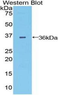 Dispatched Homolog 1 (DISP1) Polyclonal Antibody - image 2