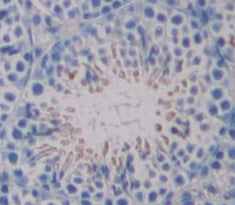 Dispatched Homolog 1 (DISP1) Polyclonal Antibody - image 3