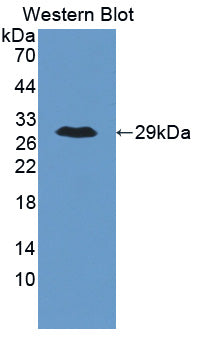 Angiopoietin Like Protein 6 (ANGPTL6) Polyclonal Antibody - image 2