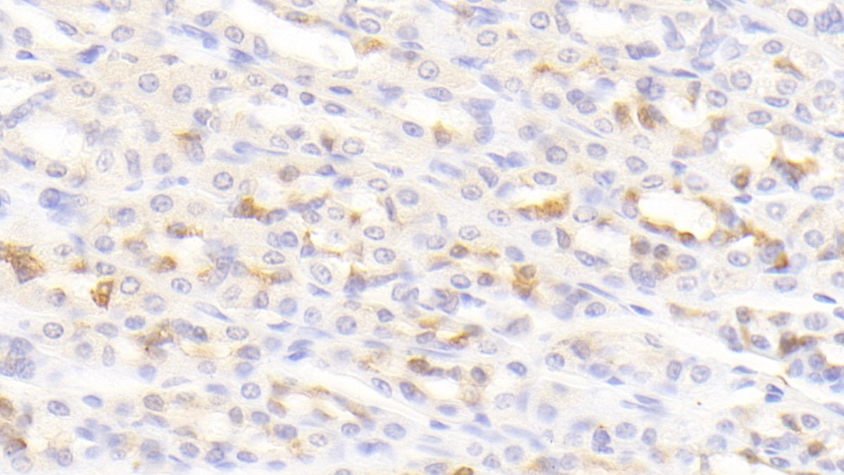 Angiopoietin Like Protein 6 (ANGPTL6) Polyclonal Antibody - image 4