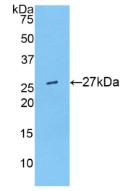 DAB staining on IHC-P; Samples: Mouse Liver Tissue;  Primary Ab: 20μg/ml Rabbit Anti-Mouse ANGPTL6 Antibody Second Ab: 2µg/mL HRP-Linked Caprine Anti-Rabbit IgG Polyclonal Antibody