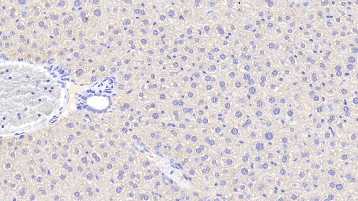 Angiopoietin Like Protein 6 (ANGPTL6) Polyclonal Antibody - image 4