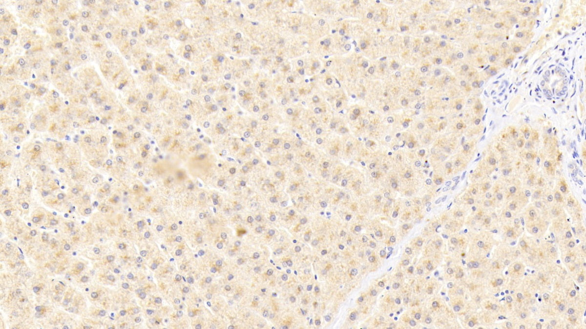 Angiopoietin Like Protein 6 (ANGPTL6) Polyclonal Antibody - image 3