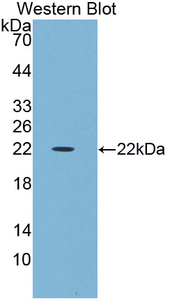 Amy1 Associated Protein Expressed In Testis (AAT1) Polyclonal Antibody - image 2